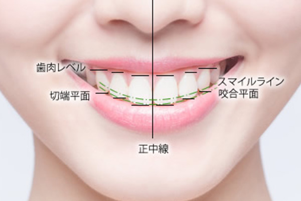 セラミック