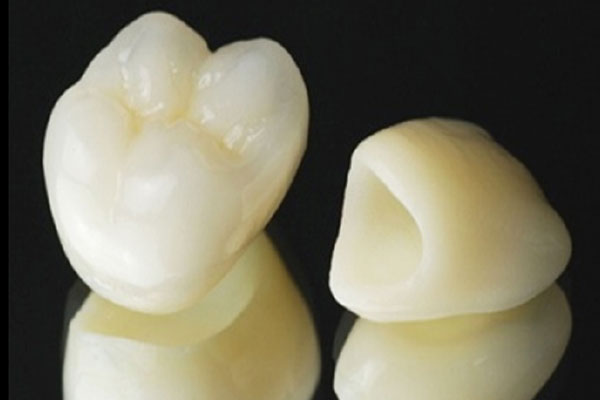 審美歯科のイメージ
