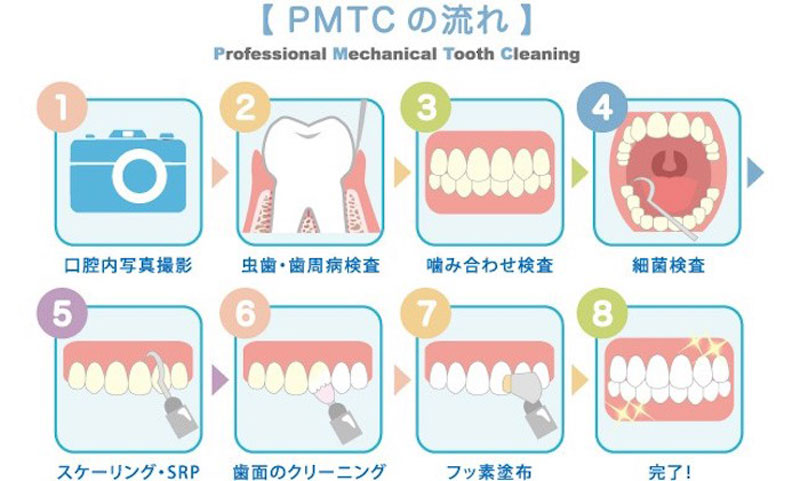 審美歯科のイメージ