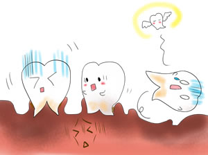歯周病ってどんな病気?