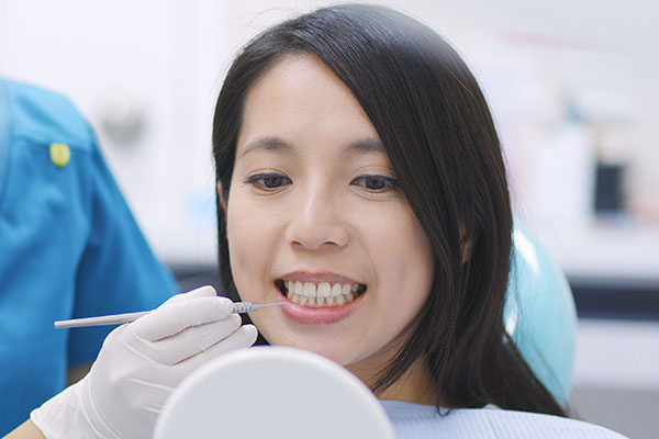  予防歯科のイメージ